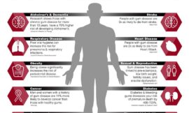 The Connection Between Oral Health and Overall Health