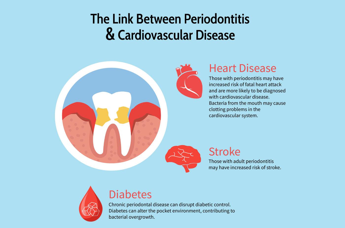 The impact of Gum Disease on Cardiovascular Health